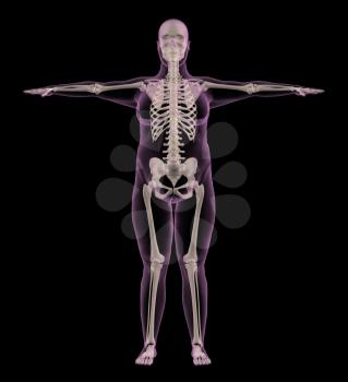 3D render of a medical skeleton of an overweight female