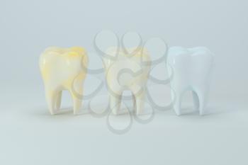 Changing of the tooth color from yellow to white, 3d rendering. Computer digital drawing.