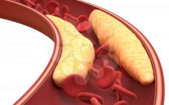 Fat and red blood cells in blood vessels, 3d rendering. Computer digital drawing.