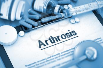 Arthrosis, Medical Concept with Pills, Injections and Syringe. Diagnosis - Arthrosis On Background of Medicaments Composition - Pills, Injections and Syringe. 3D.