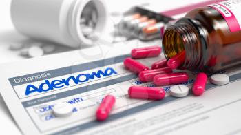 Handwritten Diagnosis Adenoma in the History of the Present Illness. Medicaments Composition of Red Pills, Blister of Pills and Bottle of Tablets. 3D Illustration.