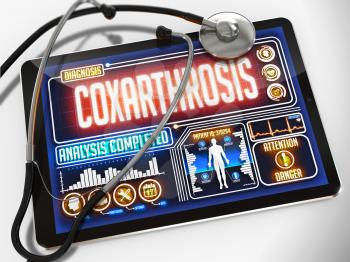 Coxarthrosis - Diagnosis on the Display of Medical Tablet and a Black Stethoscope on White Background.