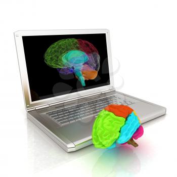 creative three-dimensional model of real human brain and scan on a digital laptop. 3d render