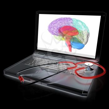 Laptop, brain and Stethoscope. 3d illustration