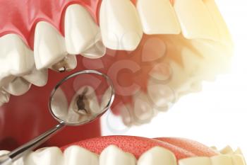 Human tooth with caries, hole and tools. Dental searching concept. Teeth or dentures. 3d illustration