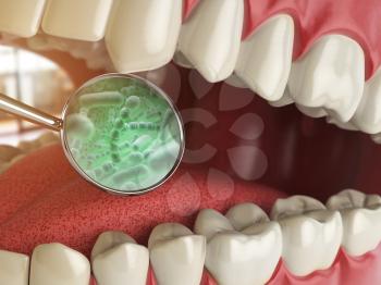 Bacterias and viruses around tooth. Dental hygiene medical concept. 3d illustration