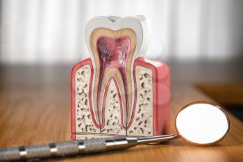 Tooth model cross section with dental mirror tool on wooden table. Close up. Dental treatment and hygiene concept. 3d illustration