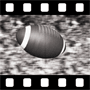 Ball Video