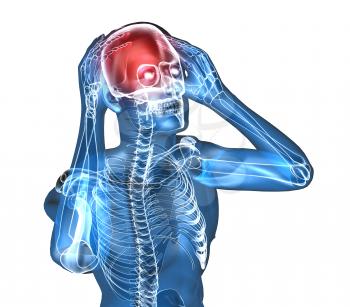 Royalty Free 3d Clipart Image of a Body With a Headache