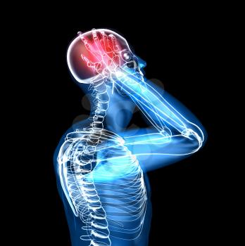 Royalty Free 3d Clipart Image of a Side View of a Body With a Headache