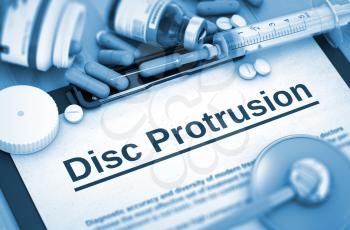 Disc Protrusion - Medical Report with Composition of Medicaments - Pills, Injections and Syringe. Disc Protrusion - Printed Diagnosis with Blurred Text.  Toned Image. 3D.