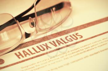 Diagnosis - Hallux Valgus. Medical Concept on Red Background with Blurred Text and Pair of Spectacles. Selective Focus. 3D Rendering.