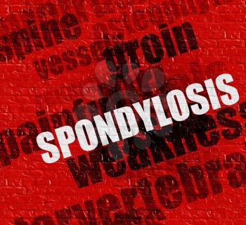 Modern medicine concept: Spondylosis on Red Brick Wall . Spondylosis - on Wall with Wordcloud Around . 