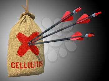 Cellulitis  Concept. Three Arrows Hit in Red Target on a Hanging Sack on Gray Background.