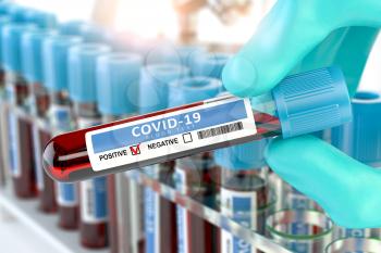 Coronavirus 2019 nCoV positive blood test. Blood sample in lhand of doctor  in laboratory. 3d illustration