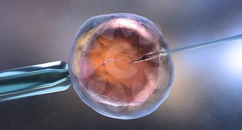 Artificial insemination or in vitro fertilization. 3D illustration